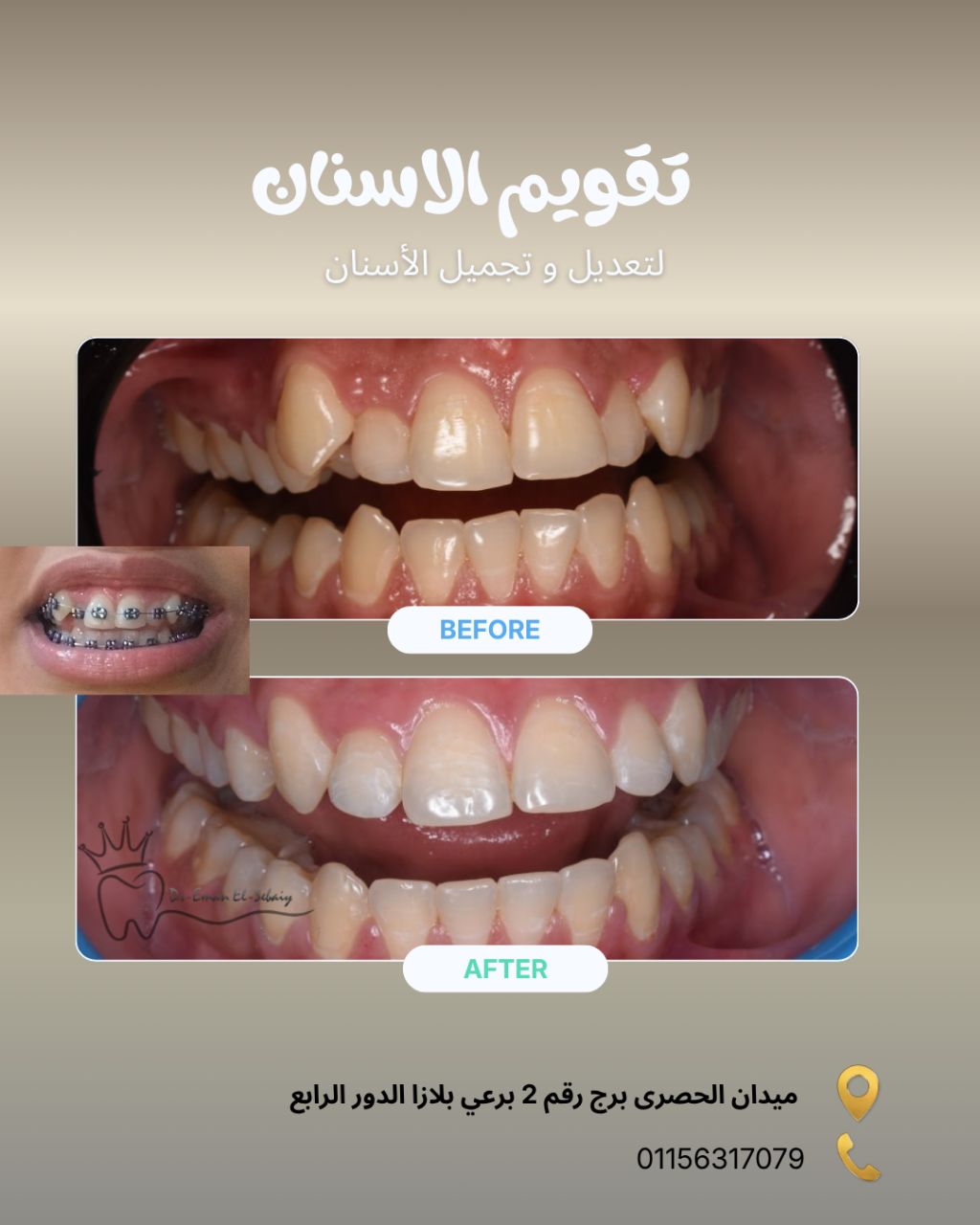 تقويم الأسنان