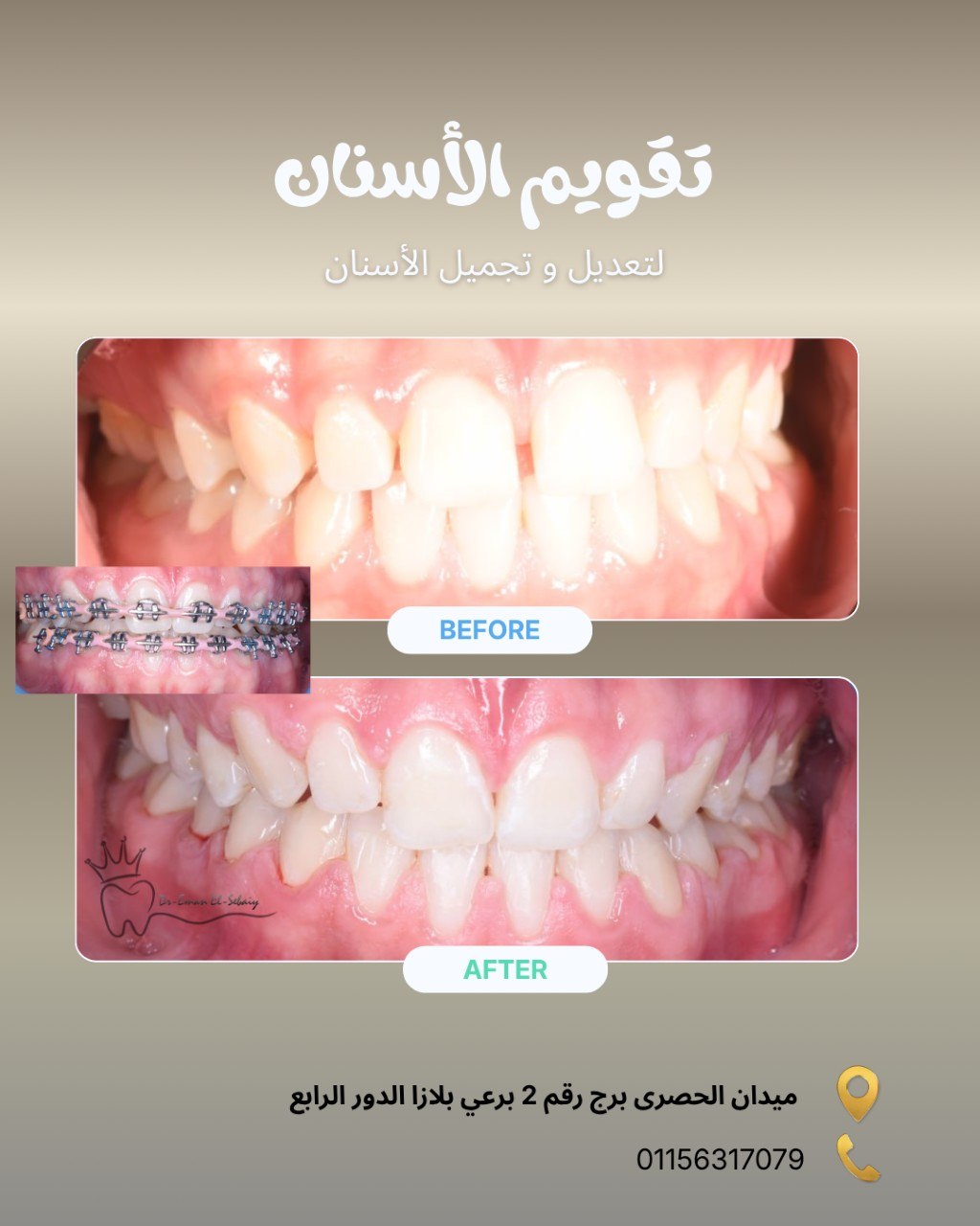 تقويم الأسنان