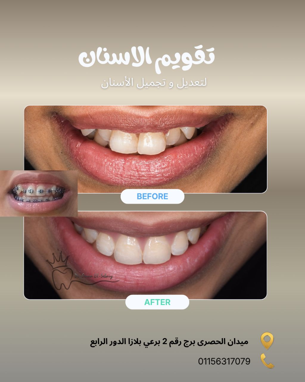 تقويم الأسنان