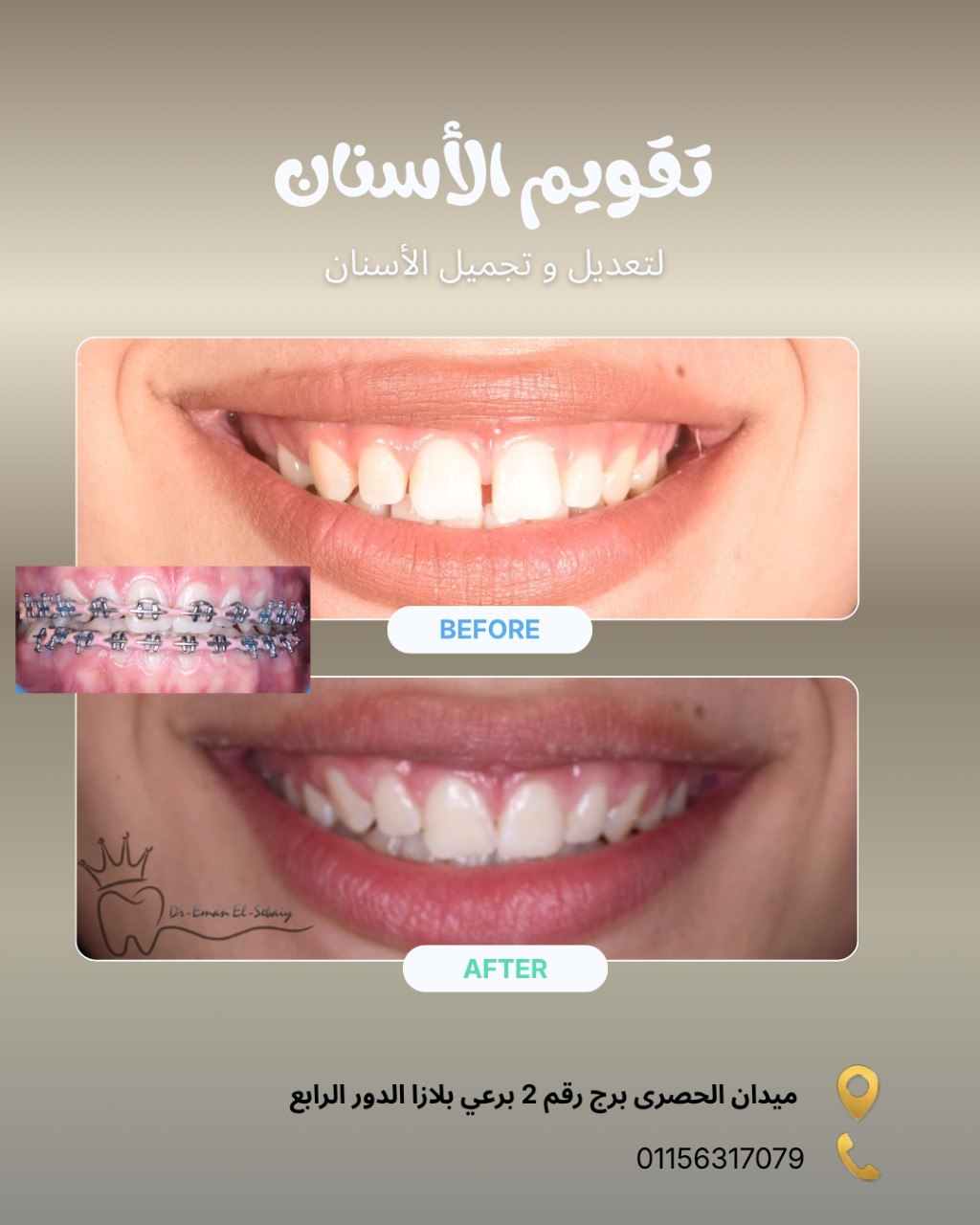 تقويم الأسنان